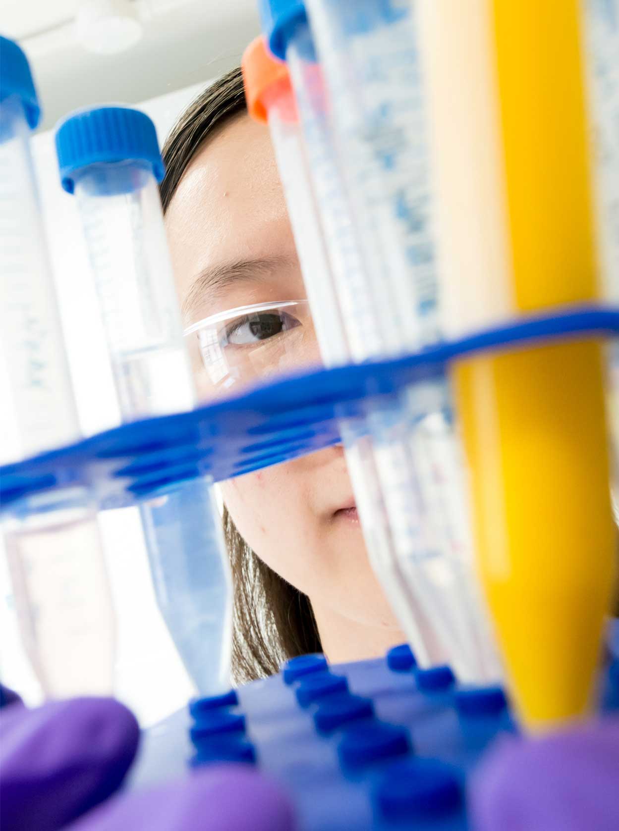 Alzheimers Research UK